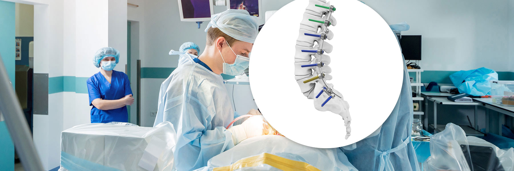Posterior Spinal Fixation