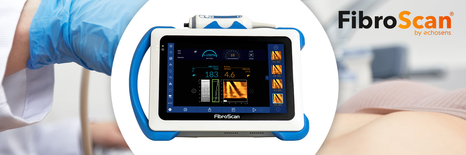 FibroScan